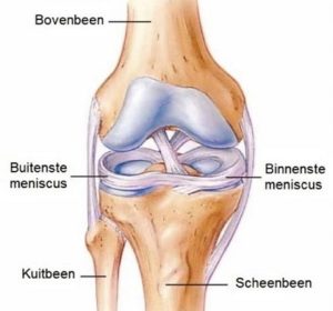Meniscus gescheurd