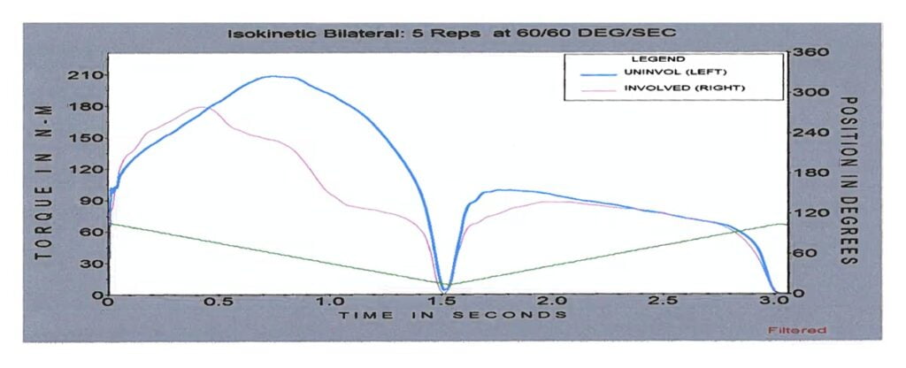 biodex test